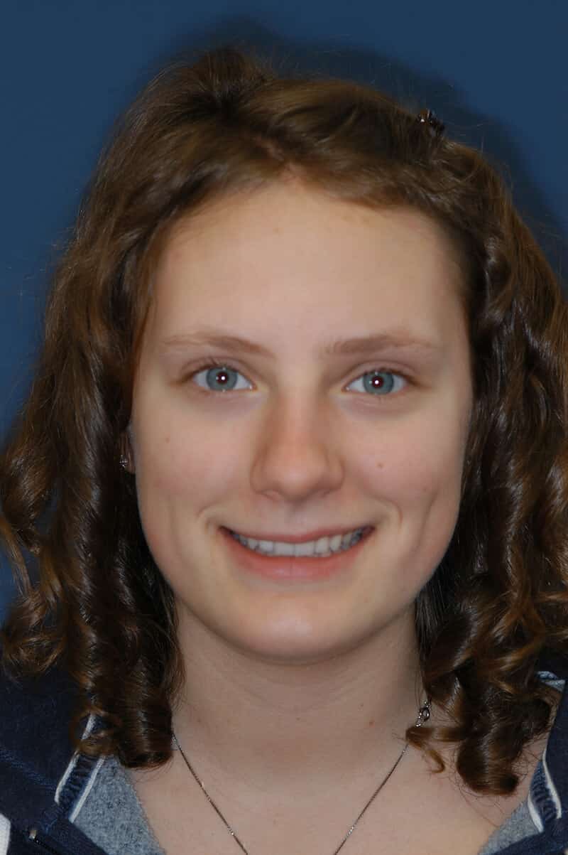 Our patient, Kristen, smiling in front a blue background after dental treatment.