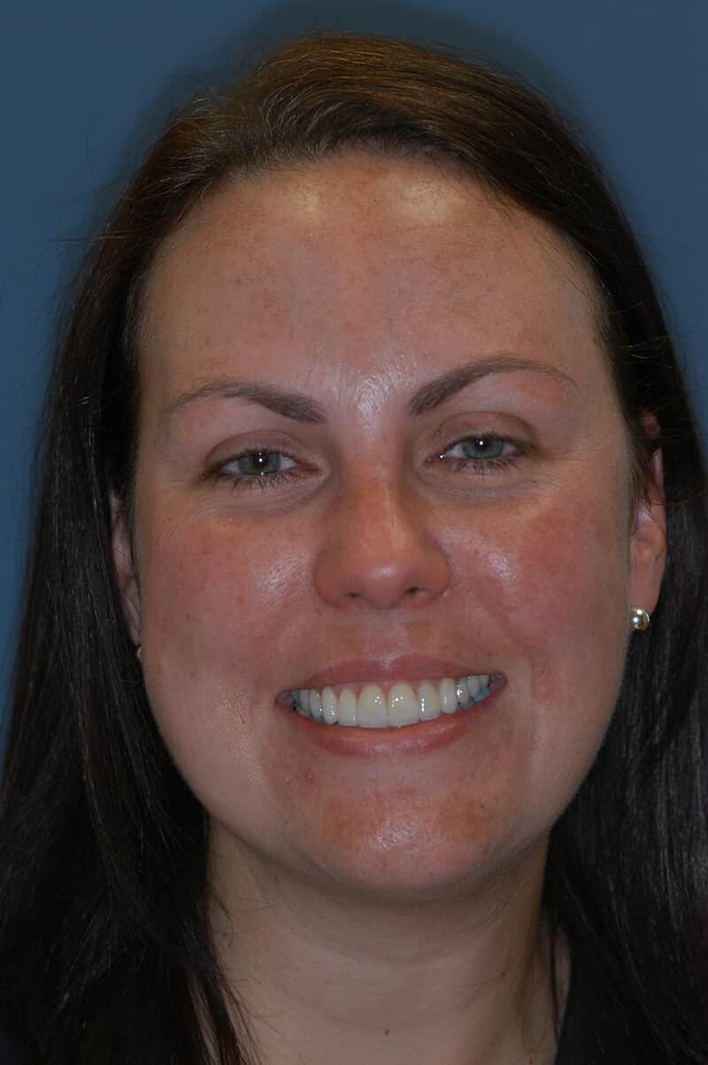 Headshot of Ann, one of Dr. Mullaney's cosmetic dentistry patients.